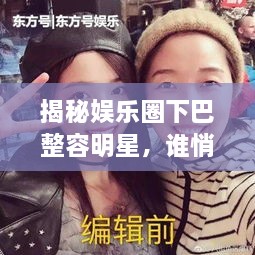 揭秘娛樂圈下巴整容明星，誰悄悄整過下巴？