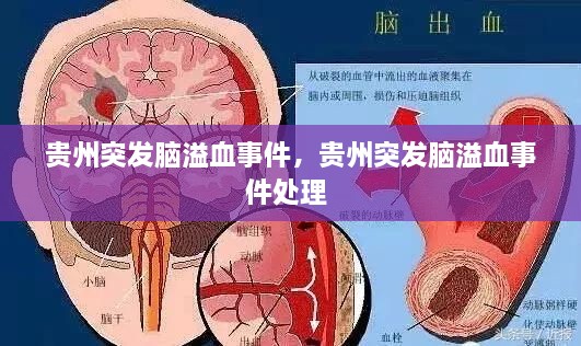 貴州突發(fā)腦溢血事件，貴州突發(fā)腦溢血事件處理 